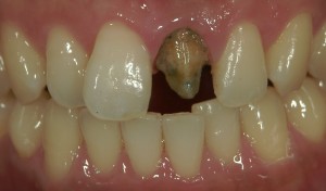 文京区の歯医者、高橋歯科クリニック文京