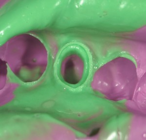 審美歯科　審美治療　高橋歯科クリニック文京