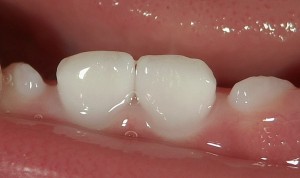 茗荷谷　千石　小児歯科　高橋歯科クリニック文京　