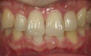 審美治療　セラミックス治療　精密根管治療　高橋歯科クリニック文京