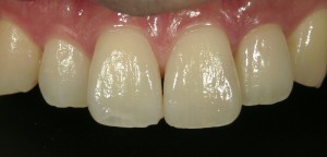 茗荷谷　千石　新大塚　歯医者　高橋　歯科クリニック　文京