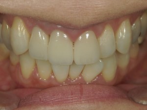 高橋歯科クリニック文京　護国寺　茗荷谷　千石　新大塚