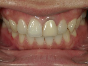 高橋歯科クリニック文京 茗荷谷 千石 新大塚 護国寺 文京区 高橋歯科クリニック文京