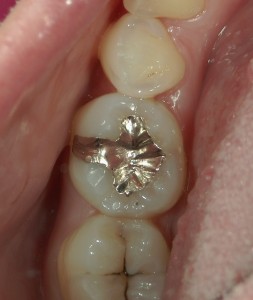 高橋歯科クリニック文京 茗荷谷 千石 新大塚 護国寺