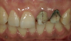 文京区の歯医者　高橋歯科クリニック文京