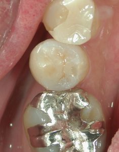 茗荷谷の歯医者高橋歯科クリニック文京