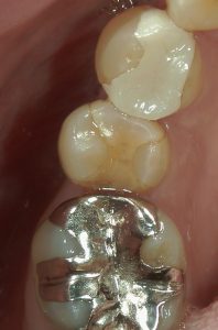 茗荷谷の歯医者　高橋歯科クリニック文京