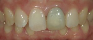 文京区千石茗荷谷の歯医者高橋歯科クリニック文京