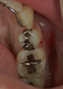 文京区千石茗荷谷歯医者高橋歯科クリニック文京