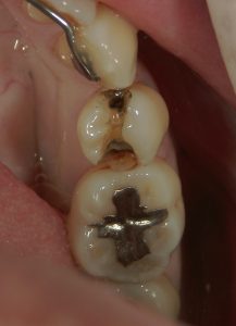 文京区千石茗荷谷歯医者高橋歯科クリニック文京