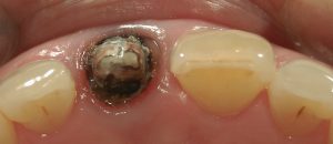 文京区千石茗荷谷歯医者高橋歯科クリニック文京