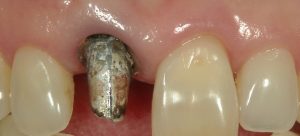 文京区千石茗荷谷歯医者高橋歯科クリニック文京