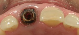 文京区茗荷谷千石歯医者高橋歯科クリニック文京