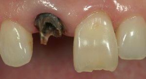 文京区千石茗荷谷歯医者高橋歯科