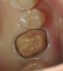 文京区千石茗荷谷歯医者高橋歯科文京