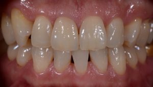 文京区茗荷谷千石歯医者高橋歯科