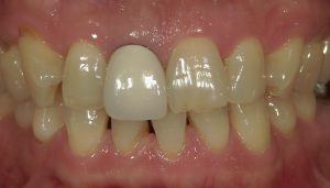 文京区千石茗荷谷歯医者高橋歯科