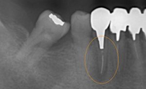 文京区茗荷谷千石歯医者高橋歯科クリニック文京