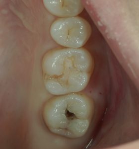 文京区千石茗荷谷の歯医者高橋歯科クリニック文京