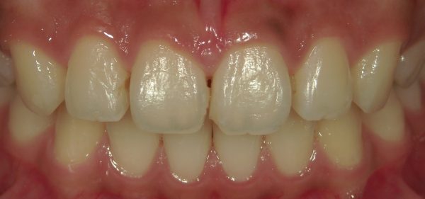 文京区千石茗荷谷歯医者高橋歯科クリニック文京