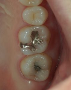 文京区千石茗荷谷の歯医者高橋歯科クリニック文京