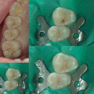 文京区千石茗荷谷歯医者高橋歯科クリニック文京