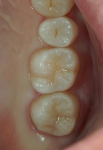 文京区千石茗荷谷の歯医者高橋歯科クリニック文京