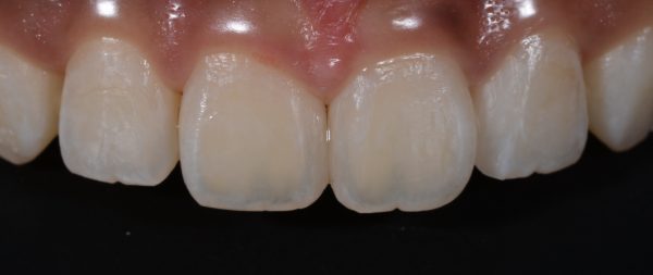 文京区千石茗荷谷歯医者高橋歯科クリニック文京