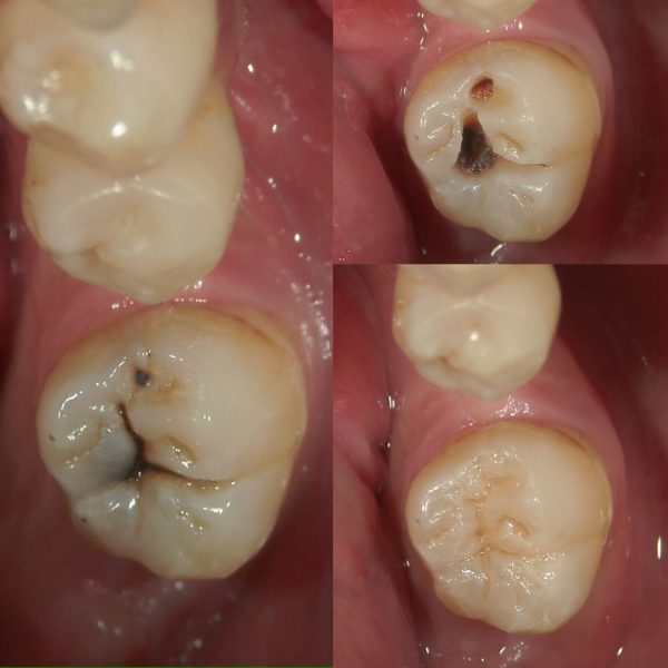 文京区千石茗荷谷歯医者高橋歯科クリニック文京