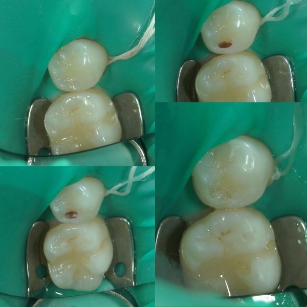 文京区千石茗荷谷歯医者高橋歯科クリニック文京