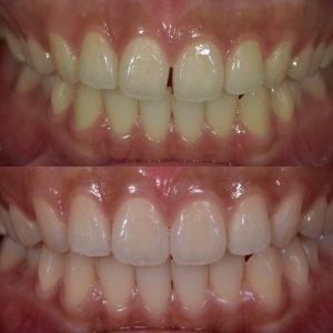 文京区千石茗荷谷歯医者高橋歯科クリニック文京