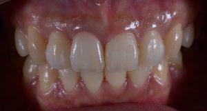 文京区千石茗荷谷歯医者高橋歯科クリニック文京