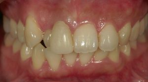 文京区茗荷谷千石歯医者高橋歯科クリニック文京