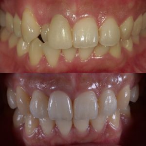 文京区茗荷谷千石歯医者高橋歯科クリニック文京