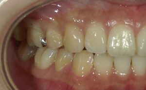 文京区千石茗荷谷歯医者高橋歯科クリニック文京