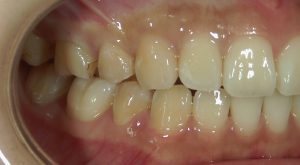 文京区千石茗荷谷歯医者高橋歯科クリニック文京