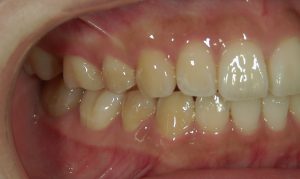 文京区茗荷谷千石歯医者高橋歯科クリニック文京