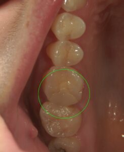 文京区豊島区茗荷谷千石高橋歯科クリニック文京