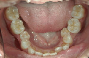 文京区豊島区茗荷谷千石高橋歯科クリニック文京