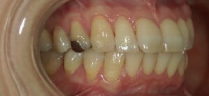 文京区豊島区茗荷谷千石高橋歯科クリニック文京