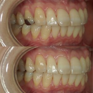 文京区豊島区茗荷谷千石高橋歯科クリニック文京