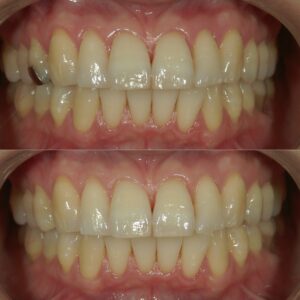 文京区豊島区茗荷谷千石高橋歯科クリニック文京