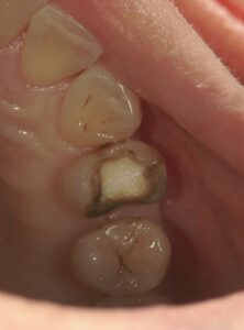 文京区豊島区茗荷谷千石高橋歯科クリニック文京