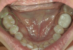 文京区豊島区茗荷谷千石高橋歯科クリニック文京