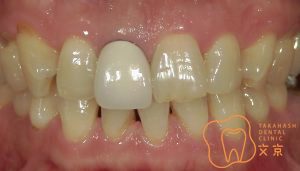 文京区千石茗荷谷豊島区髙橋歯科クリニック文京