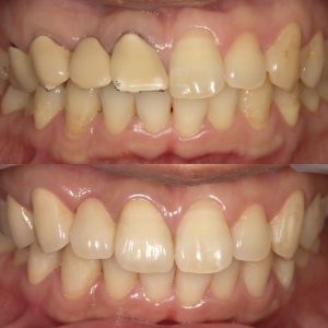 文京区千石茗荷谷歯医者高橋歯科クリニック文京