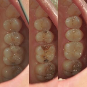 文京区豊島区茗荷谷千石髙橋歯科クリニック文京