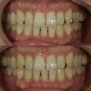 文京区茗荷谷千石歯医者,高橋歯科クリニック文京