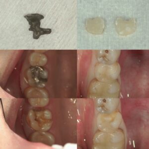 文京区豊島区茗荷谷千石歯医者高橋歯科クリニック文京
