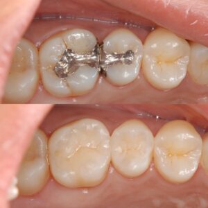 茗荷谷千石文京区豊島区髙橋歯科クリニック文京